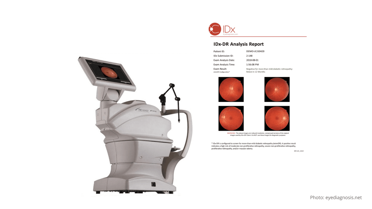 The first FDA-approved AI-based diagnostic device to examine eye disease